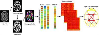 Rich-Club Organization Disturbances of the Individual Morphological Network in Subjective Cognitive Decline